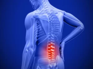 درمان کمر درد با ورزش