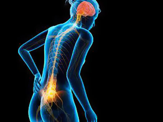 درد سیاتیک بدون جراحی