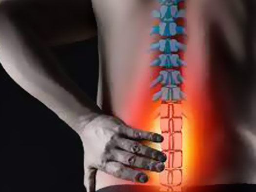درمان کمر درد با ورزش